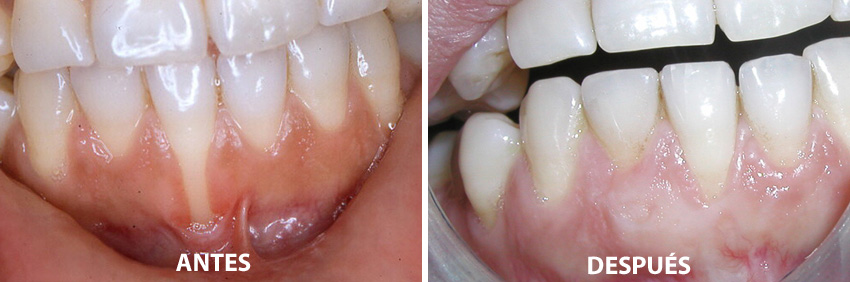 Periodoncia • Clínica Segarra Vidal - Periodoncia