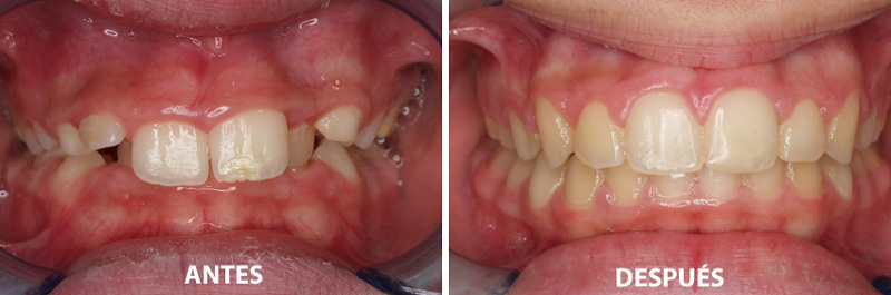 Periodoncia • Clínica Segarra Vidal - Periodoncia